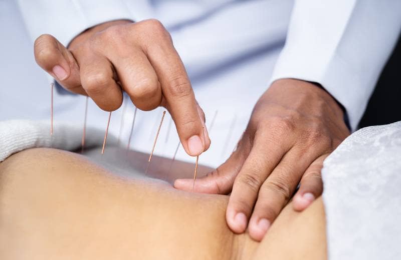 Acupuntura ofrecida por Clínica Multidisciplinaria